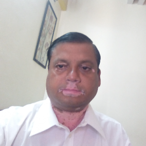 Pramod Asol-Freelancer in lucknow,India